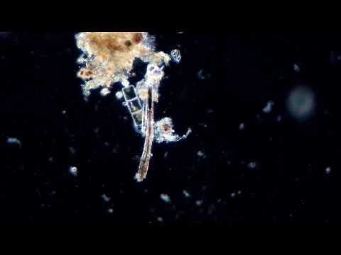 Темнопольный конденсор своими руками