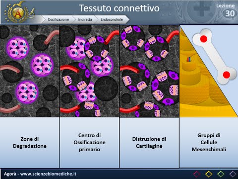 Trattamento di lombare LFK osteocondrosi sacrale Nave piegato nella colonna vertebrale cervicale