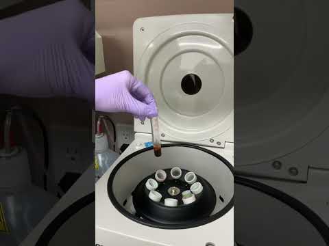 甲状腺検査 – 何をすべきか、そして結果は何を意味するか