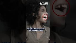 THE DAY AMY WINEHOUSE LOST A TOOTH 🦷 #amywinehouse #singer #fail #dentistry #ytshorts