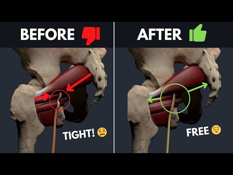How To Un-Fu*k Your Piriformis & Sciatic Nerve - Fix Low Back Pain, Numbness, & Sciatica