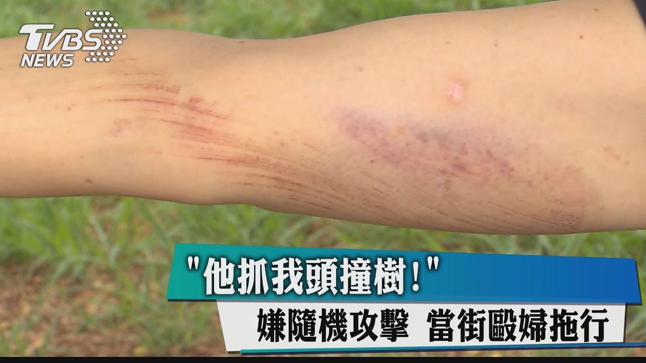 「他抓我頭撞樹!」 嫌隨機攻擊當街毆婦拖行