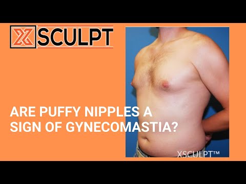 What causes puffy nipples in men? | XSculpt™