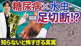 水虫に関する動画2