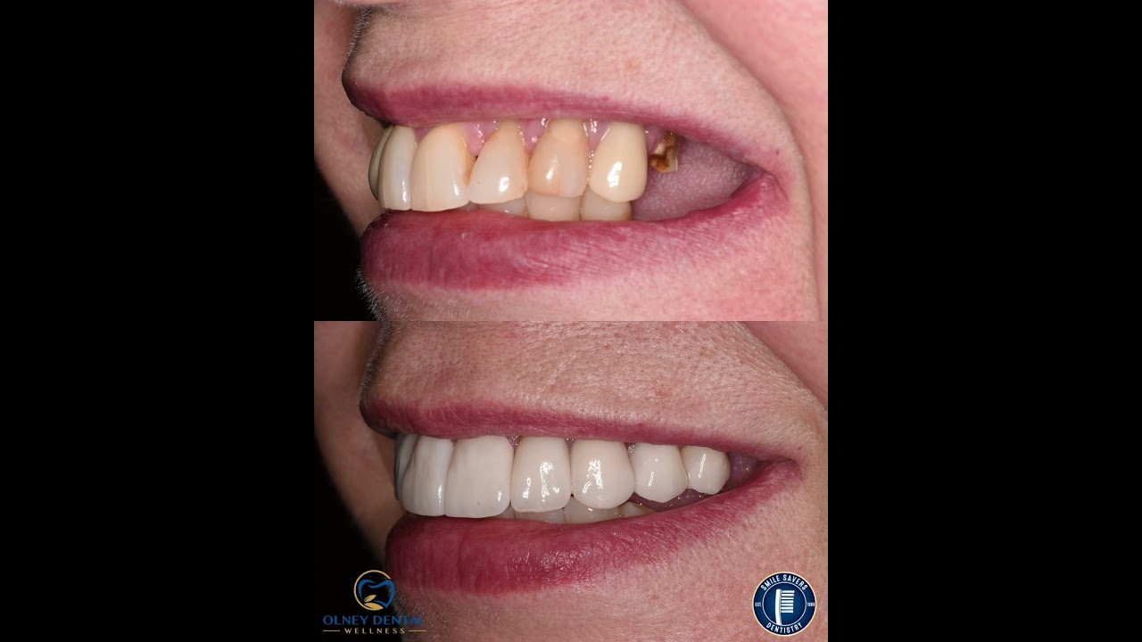 Smile Gallery Video 4