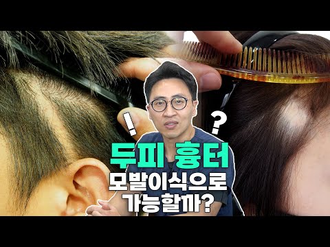 머리 땜빵, 어떻게!? 고민하고 계시다면 이 영상을 봐주세요