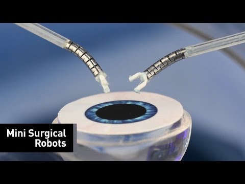 Axsis, a Minimally Invasive Robot, Performs Cataract Surgery