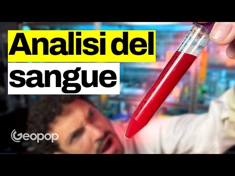 We entered a blood analysis laboratory: from the blood collection tube to the report