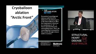 Atrial Fibrillation Ablation: Radiofrequency vs Cryoballoon – Dr David Whalley