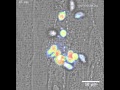 Toxoplasma parasites busting out of their human host cells