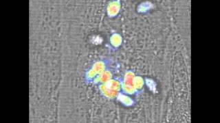 Toxoplasma parasites busting out of their human host cells