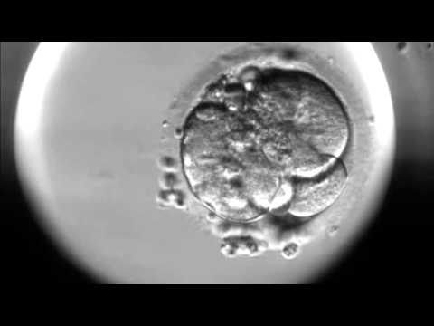 Timelapse of fertilisation of a human egg under the microscope