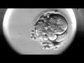 Timelapse Of Fertilisation Of A Human Egg Under The Microscope