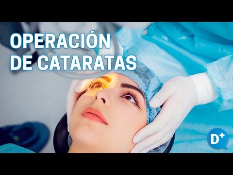 Operación de cataratas