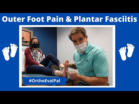 Outer Foot Pain with Plantar Fasciitis