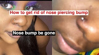 HOW TO GET RID OF NOSE PIERCING BUMP/KELOID FAST AND EASY