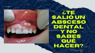 ABSCESO DENTAL ¿Qué es y cómo eliminarlo