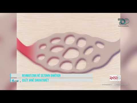 Hipokrati - Dimri për Sëmundjet Reumatizmale!  18 Dhjetor 2021