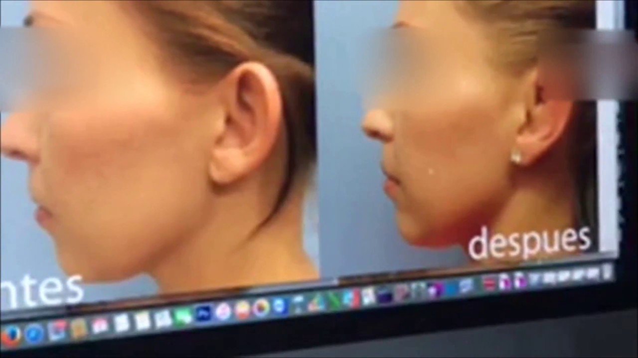 Rogelio Reza Gallegos-32