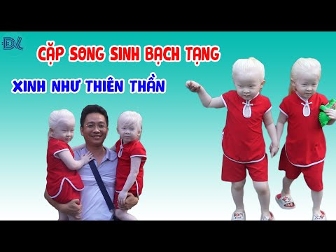 , title : 'Phát hiện ở Việt Nam có cặp song sinh thiên thần - ĐỘC LẠ BÌNH DƯƠNG'