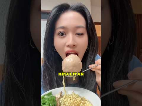 Kondisi Langka Ini Tak Mengubah Cinta Pacarnya