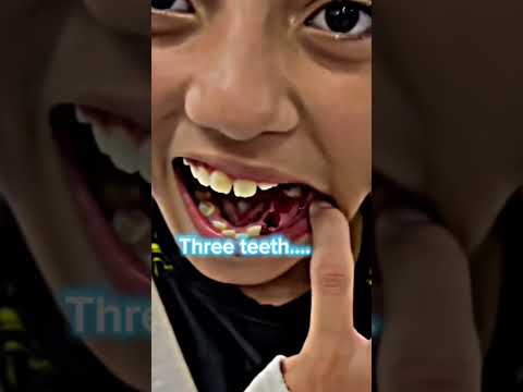 Boxer !! #troll #trollface #edit #editing #short #virashort #shortvideos #trollfacecoolmomentscompi