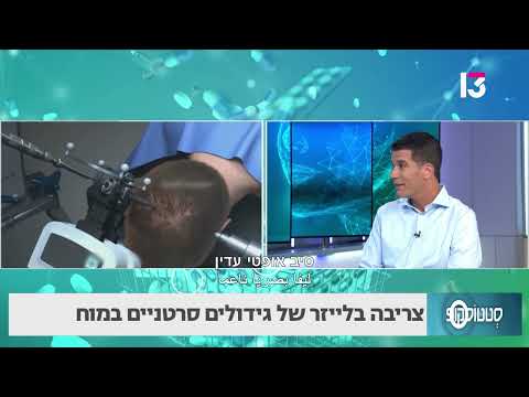 צריבה בלייזר של גידולים סרטניים במוח