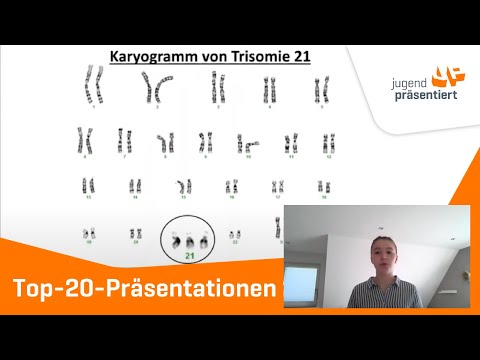 Das Down-Syndrom - eine Verbindung mit Folgen