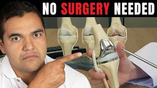 Watch This Before You Get a Knee Replacement (99% Chance You Won’t Need One)