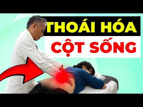 TẠI SAO THOÁI HÓA CỘT SỐNG NGÀY CÀNG NẶNG? SAI LẦM NHIỀU NGƯỜI ĐANG MẮC!