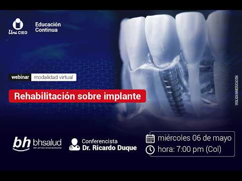 Webinar - Rehabilitación sobre implante