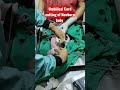 Umbilical Cord Cutting of newborn Baby