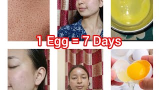 I Used Egg On My Face For 7 Days & THIS HAPPENED! *Shocking Results😱
