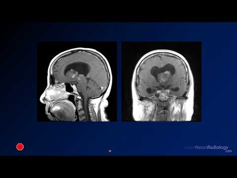Neuroradiology board review 3 case 1