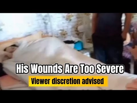 When All Hope Seems Lost | A Life Confined to a Bed