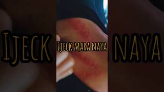 Download lagu kerokan merah windy shorts mp3 Download lagu kerokan merah windy shorts mp3