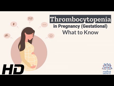 Thrombocytopenia in Pregnancy: Risks, Symptoms, and Treatmen