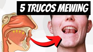 5 TRUCOS Para Colocar La LENGUA EN EL PALADAR - MEWING