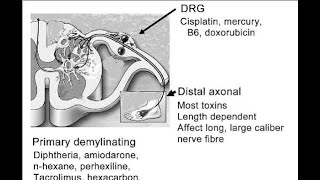 Toxic Neuropathies; nerve disorders caused by exposure to harmful substances  drugs, heavy metals