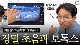 침샘 보톡스 이렇게 맞아보세요(초음파 리얼 영상)