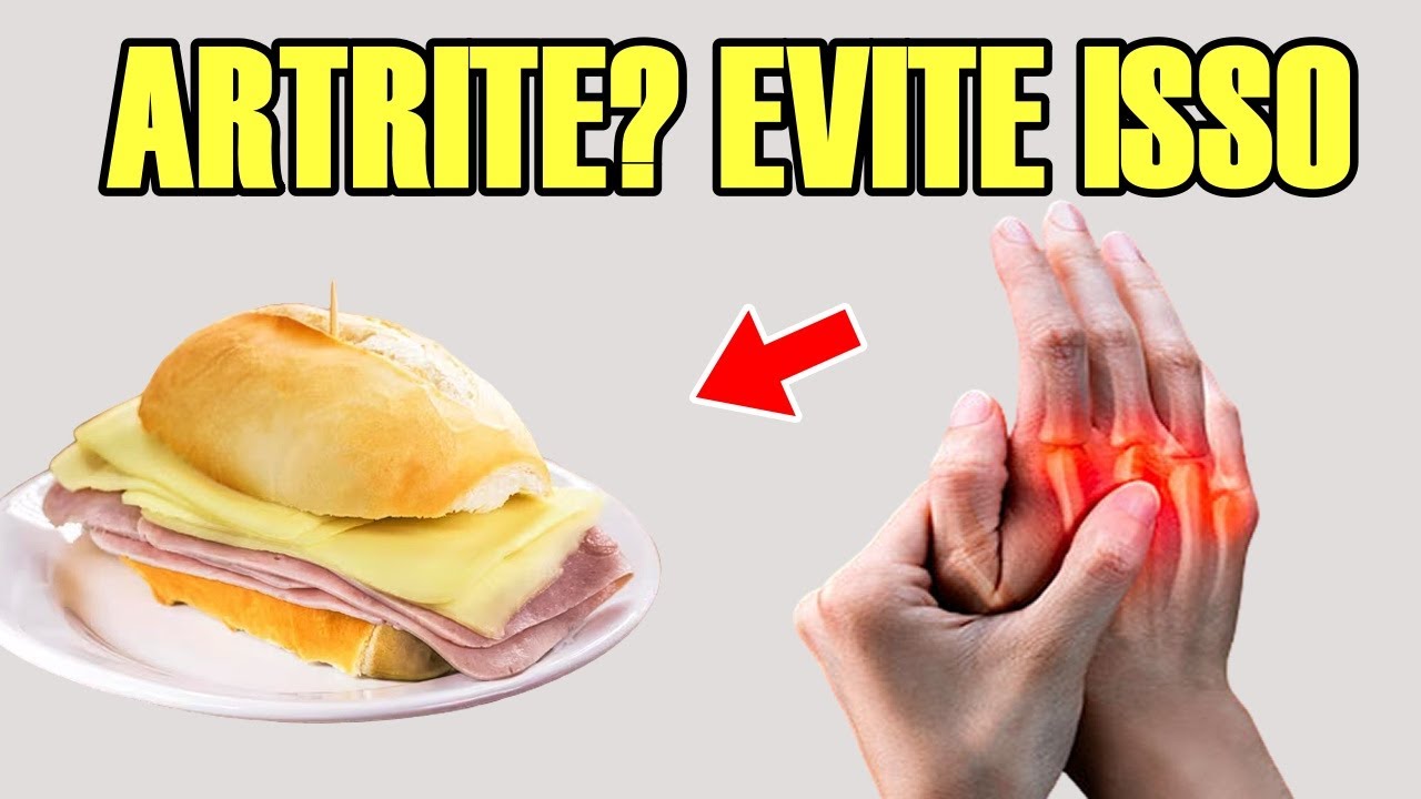 9 ALIMENTOS QUE EU EVITARIA SE TIVESSE ARTRITE