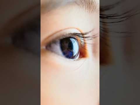 How Atropine Eye Drops Help Slow Myopia in Kids | Pediatric Eye Care Explained