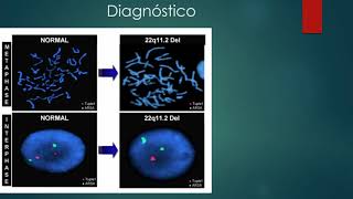 Anomalias Congénitas - Segunda parte