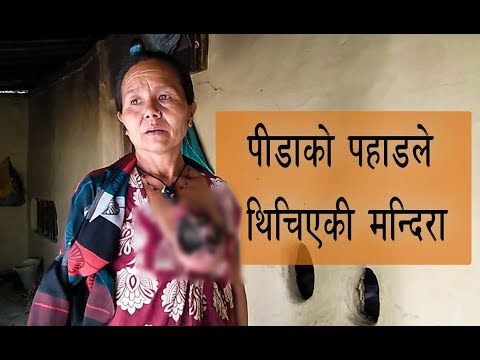 स्तनको ‘डरलाग्दो’ घाउ देखाउँदै मन्दिराले भनिन् : मलाई बचाइदिनुहोस्