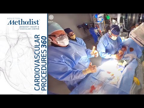 Superior Mesenteric Artery Stenting—360 video (Alan Lumsden, MD; Trisha Roy, MD; Mujeeb Zubair, MD)