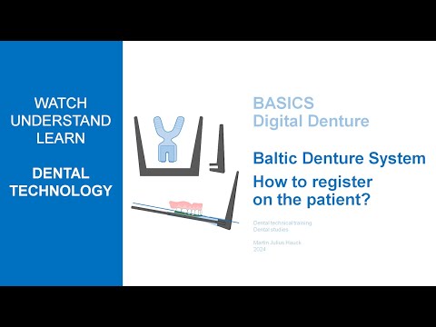Baltic Denture System | How to register on the patient?