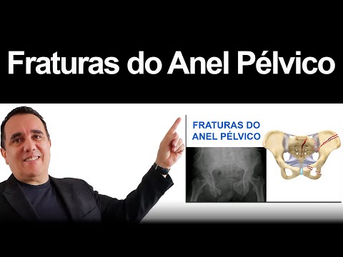 Fraturas do Anel Pélvico
