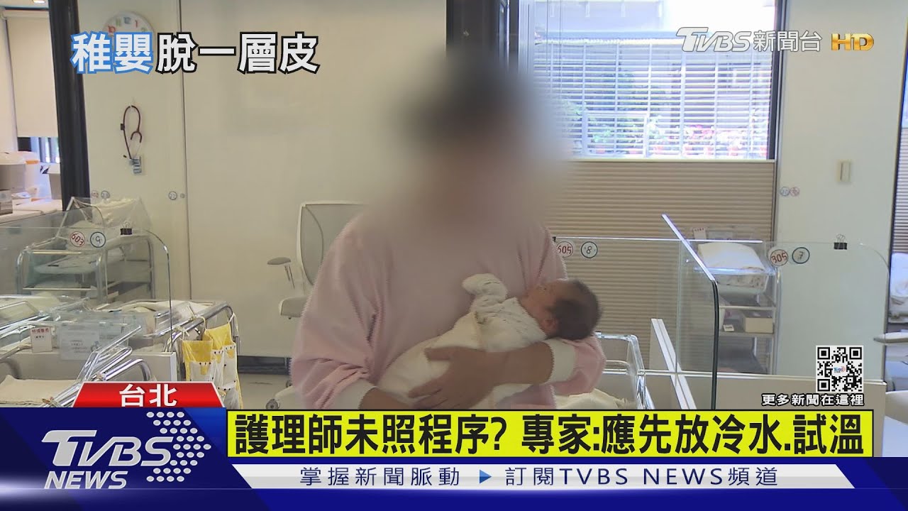 女嬰醫院洗澡全身25%燙傷 母心痛難過