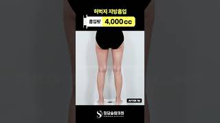 허벅지 라인 정리되니까 느낌부터 다름💝