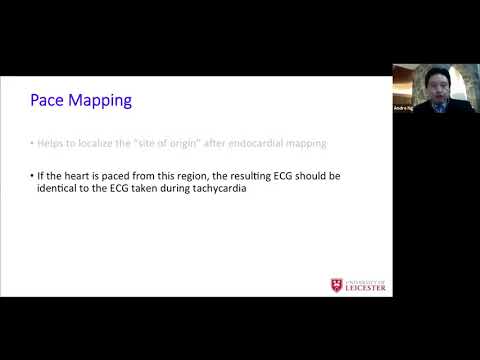 IDIOPATIC VT ABLATION AND NEW MAPPING TOOLS